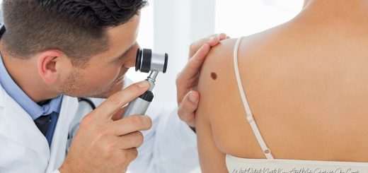 What Patients Need to Know About Mohs Surgery for Skin Cancer